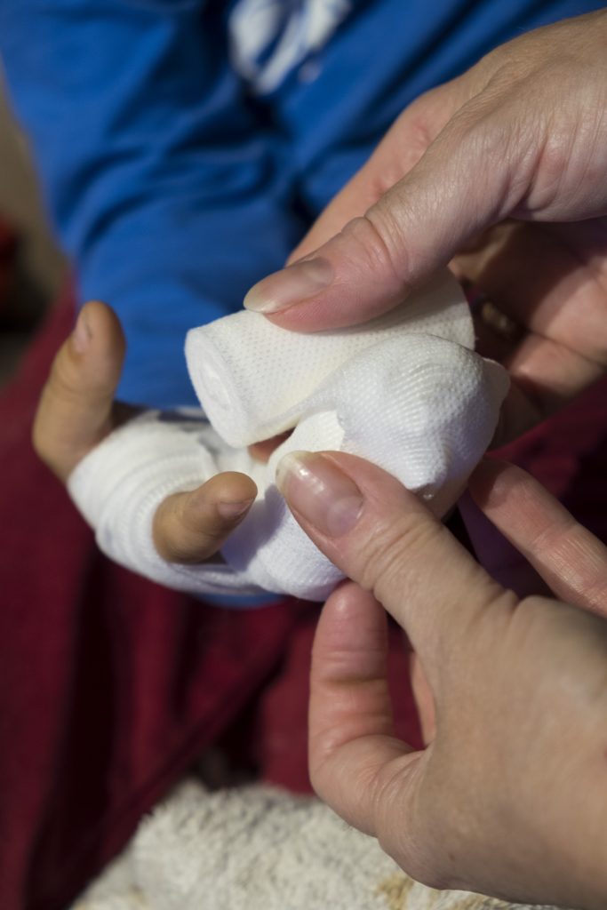 Pansement bandage main enfant